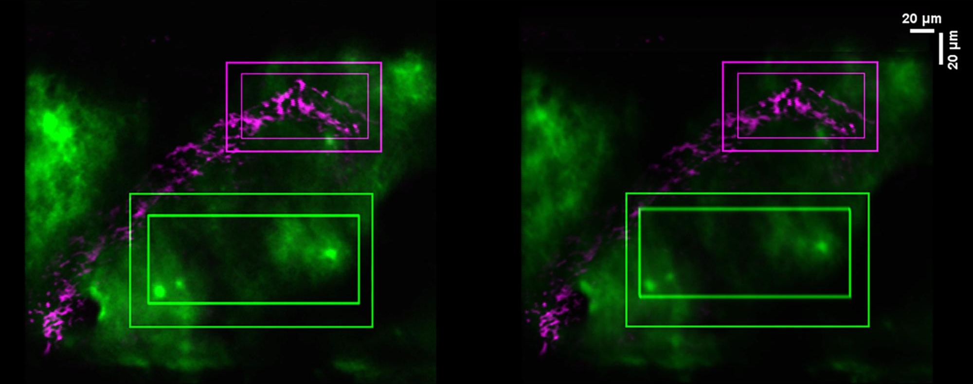 microscopy image of brain tissue, with areas glowing in green and purple