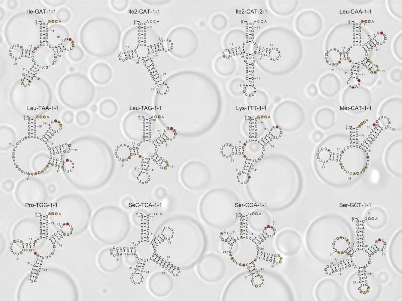 Structure of tRNA molecules overlaid on image of membraneless compartments