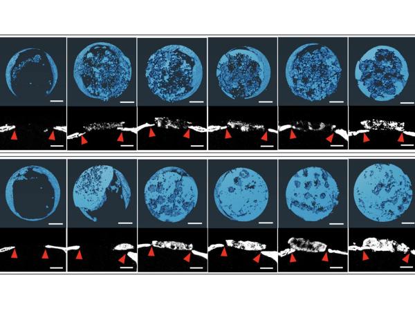 grid of microscopic bone xprays