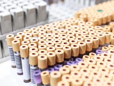 many test tubes. Credit: Getty Images