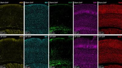 several images of brain tissue