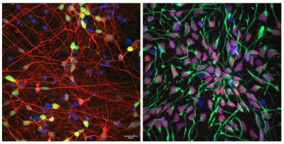 two images of neurons stained with different color dye