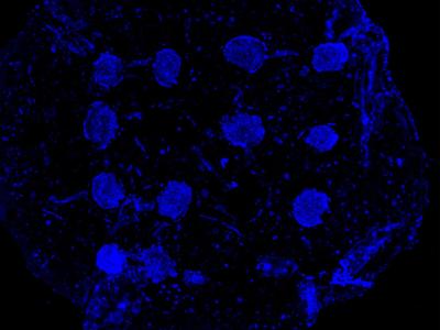 spheroids glowing with fluorescence