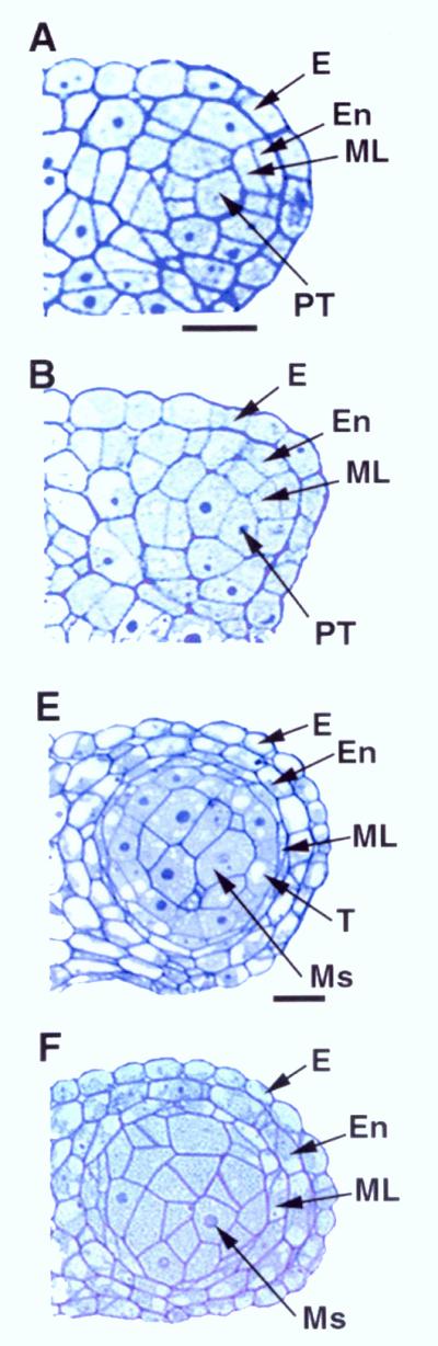 Comparison of the wild-type and ems1 mutant anther development. The microscope images show the upper right lobe of the anther.