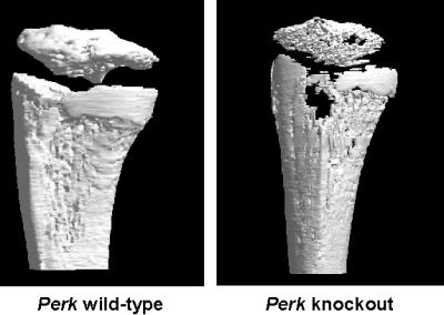 Micro x-ray computed tomography (microCT) images of the tibia of normal and Perk mutant mice. The mutant shows thin cortical bone with deformations and gaping holes. "If it wasn't for muscle and connective tissue to hold these fragile bones together, these mice would fall apart," Cavener says.