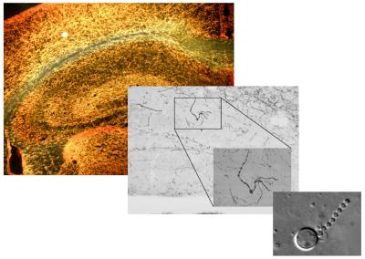 A simple biophysical model of an axon was used to study the catastrophic consequences of oxidative stress to neurons. 