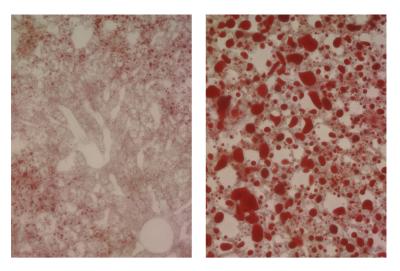 Normal mice fed a diet deficient in leucine do not accumulate fat in their liver (left panel) whereas mutant mice that lack the GCN2 enzyme develop a massive accumulation of fat (severe hepatic steatosis), as seen in the right panel (red droplets). Credit: Douglas Cavener lab, Penn State