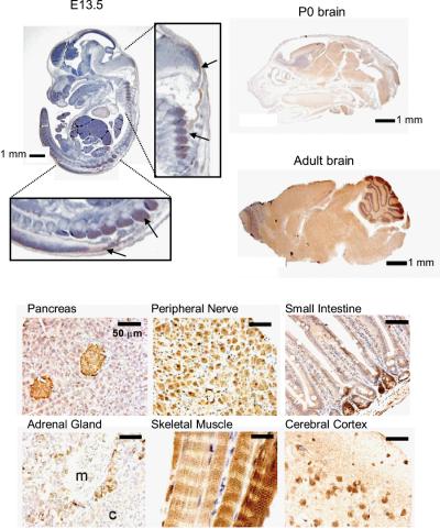 The DANGER family member, DANGER1A, is expressed in a variety of cells (brown color) which lose their ability to divide including nerves, muscle, and neuroendocrine cells. DANGER1A is first expressed in the developing mouse (embryonic stage 13.5) in the spinal cord (arrows), with increasing expression in post-natal day 0 mice, and is maximal in the adult mouse brain. Credit: D. Neil Watkins (Sidney Kimmel Cancer Institute, Johns Hopkins University) 