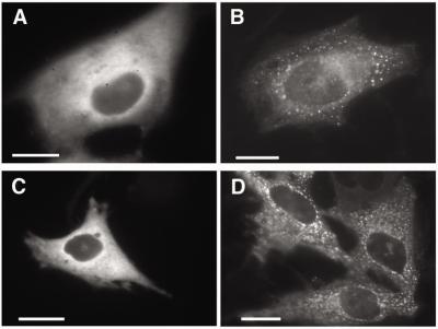 Credit: Erin Sheets lab  In these microscopic images of cells, the white areas indicate the presence of enzymes. The enzymes in images A and C are distributed throughout the cytoplasm because these cells were grown in the presence of purines. In contrast, the enzymes in images B and D occur in small clusters because these cells were grown in the absence of purines.