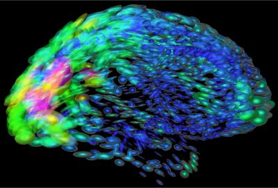 Artist's visualization of the human brain.  Nerve cells in the brain are responsible for maintaining a threshold between rest and excitement in response to stimuli.  CREDIT: Arthur Toga, University of California at Los Angeles via the National Institute of General Medical Sciences.