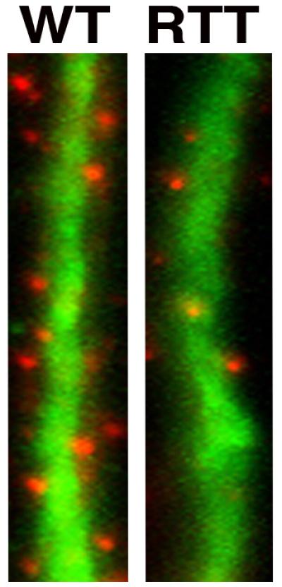 Neurons generated from Rett-iPS cells form fewer synapses, the specialized signal transmission points between brain cells. Synapses are shown in red and dendrites, which function as signal receivers, are shown in green. Image courtesy of Dr. Carol Marchetto, Salk Institute for Biological Studies.