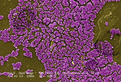 This colored 2005 scanning electron micrograph (SEM) shows numerous clumps of methicillin-resistant Staphylococcus aureus bacteria, commonly referred to by the acronym, MRSA, magnified 2390 times. Credit: Janice Haney Carr/CDC/ Jeff Hageman, M.H.S.