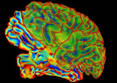 This image of a human brain is an example of the kinds of brain scans that are used in some neuroscience research studies. Credit: National Institute of Mental Health, National Institutes of Health, Department of Health and Human Services