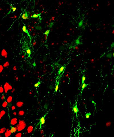 Researchers at Penn State University led by biologist Gong Chen have developed an innovative technology to regenerate functional neurons after brain injury, and also in model systems used for research on Alzheimer's disease. 