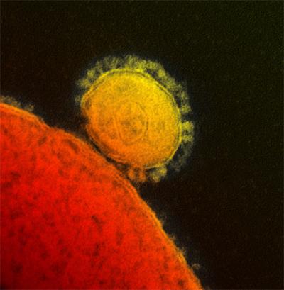 An article by Marcel Salathé and his colleagues in the New England Journal of Medicine describes a new field of research known as digital epidemiology. This field is of increasing importance for tracking outbreaks of infectious diseases such as the one caused by a novel coronavirus, pictured here.  Credit: Rocky Mountain Laboratories, National Institute of Allergy and Infectious Diseases, National Institutes of Health