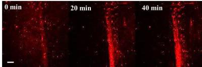 This research-microscope image shows the increasing density at the bone-crack site during a 40-minute test of particles carrying the bone-healing medication. The particles were treated with a red-glowing fluorescent dye. Credit: Sen laboratory, Penn State University