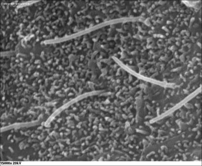 Using mouse models, Penn State cellular biologist Aimin Liu and his colleagues discovered a protein that is required for the growth of critical, hair-like structures called cilia on cell surfaces. The cilia on a mouse embryo, shown in this micrograph, would not be able to grow without the protein C2cd3. Credit: Aimin Liu Lab, Penn State University.