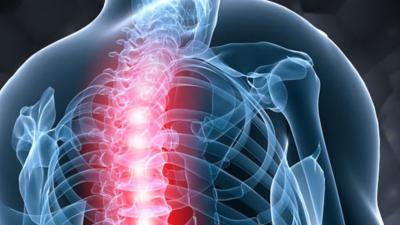 An artist's rendition of a human spinal cord. Credit: EMSL CREATIVE COMMONS LICENSE