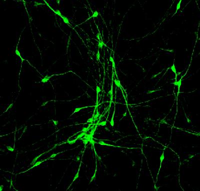 Astroglial cells after treatment with small-molecule cocktails in the lab of Gong Chen at Penn State University, showing transformation into neurons with long axons and dendrites. Credit: Gong Chen lab, Penn State University
