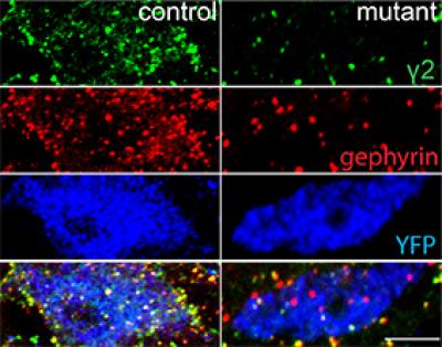 Microscope images of SST+ interneurons from a control brain (left) and a mutant brain with the GABA receptor disabled (right). The cells are stained with fluorescent dyes labeling the GABA receptor (green), an associated scaffolding protein (red), and the cell body (blue). Loss of green and red staining in the mutant indicates the loss of GABA inhibition in these cells, which leads to antidepressant activity. Credit: Lüscher laboratory, Penn State University.