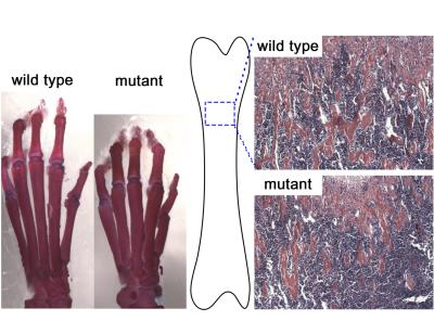 Knocking out the Spop protein in developing mouse limb leads to brachydactyly, a shortening of the fingers and toes (left) and reduced bone density (right). Credit: Liu Laboratory, Penn State University.