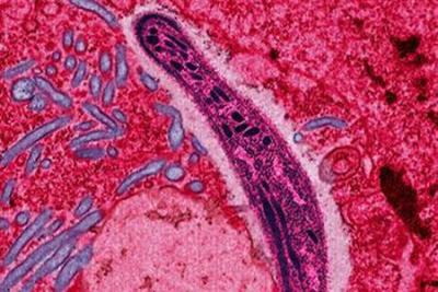 A false-color electron micrograph of the malaria-causing Plasmodium parasite infecting a mosquito. Image courtesy of Margaret Shear, Wikipedia