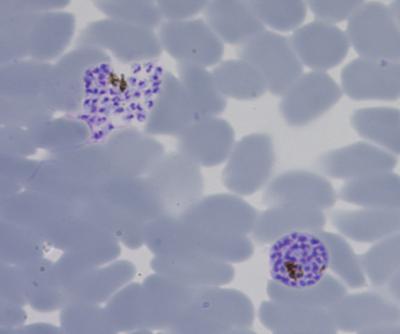 Malaria parasites replicate into many daughter cells inside red blood cells. The red blood cells eventually burst (cell on the left), allowing the parasites to infect new red blood cells. In hosts with reduced calorie intake, fewer daughter cells are produced per round of replication, decreasing the severity of the infection and potentially allowing the host to survive longer. Credit: Maria Mota Laboratory, iMM Lisboa