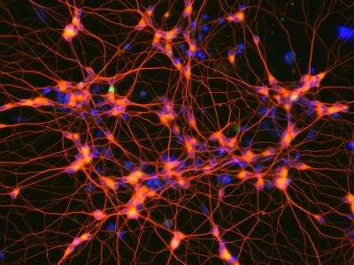 Induced motor neurons created by direct programming from mouse embryonic stem cells. A team of scientists has analyzed the changes that take place in the cells during reprogramming, uncovering a dynamic multi-step process. Credit: Esteban Mazzoni, NYU