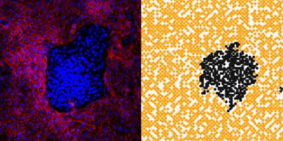 Mathematical model mimics melanoma. Left: melanoma cells grown in culture with normal cells form clusters that resemble proto-tumors. Right: Simulations using a modified version of the Widom-Rowlinson model replicate patterns of melanoma cell growth seen in laboratory experiments by controlling the exclusion area -- the amount of space required -- around two types of simulated cells as they grow and spread. Credit: Penn State