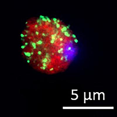 Fluorescent staining of the CAF1/CCR4/NOT complex in the malaria parasite. This complex, which new research shows is important for RNA stability and the maturation of the male sexual form of the malaria parasite, is found as granules (green) throughout the cytosol of the malaria parasite. Credit: Kevin J. Hart, Penn State