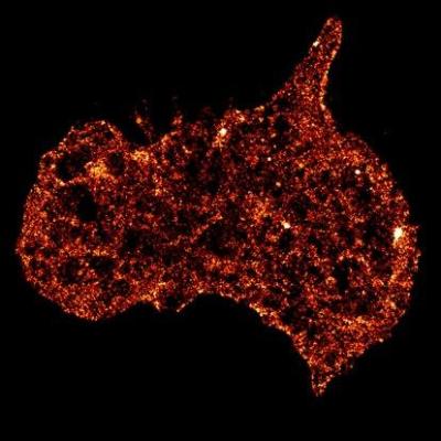 An activated human platelet, a blood-clotting cell that plays a crucial role in preventing bleeding, but when overactivated can play a role in cardiovascular diseases such as heart attack and stroke. New research identifies one of the main mechanical mechanisms of blood clotting. Credit: Lining Arnold Ju (University of Sydney) and Qian Su (University of Technology Sydney).
