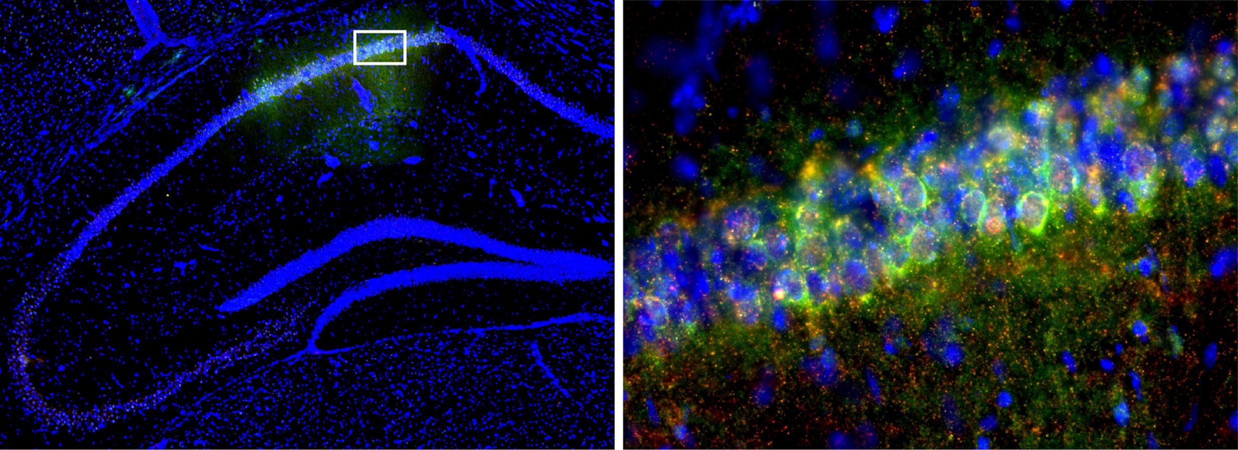 Flourescent stain of dorsal hippocampus showing CRISPR expression