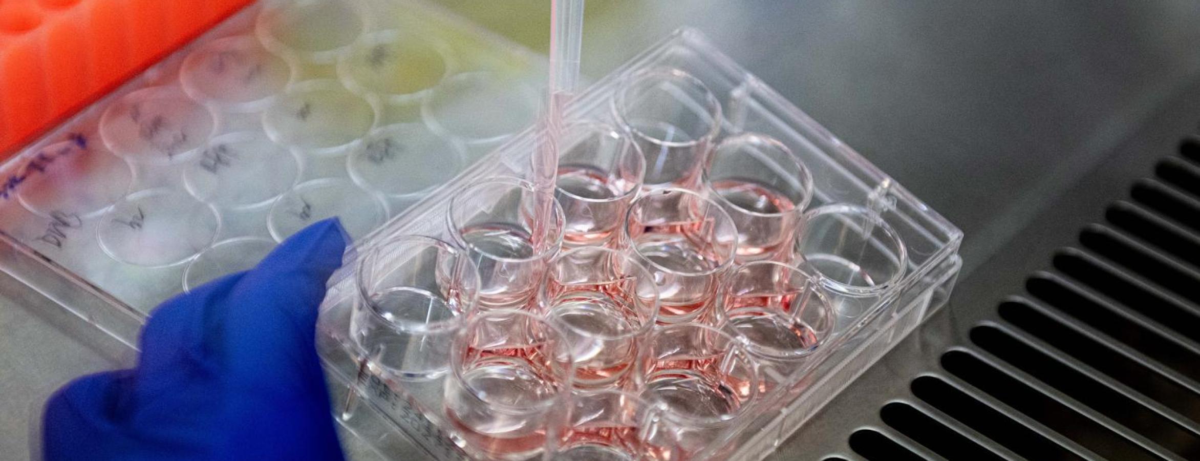 gloved hand holding tray while another hand pipettes