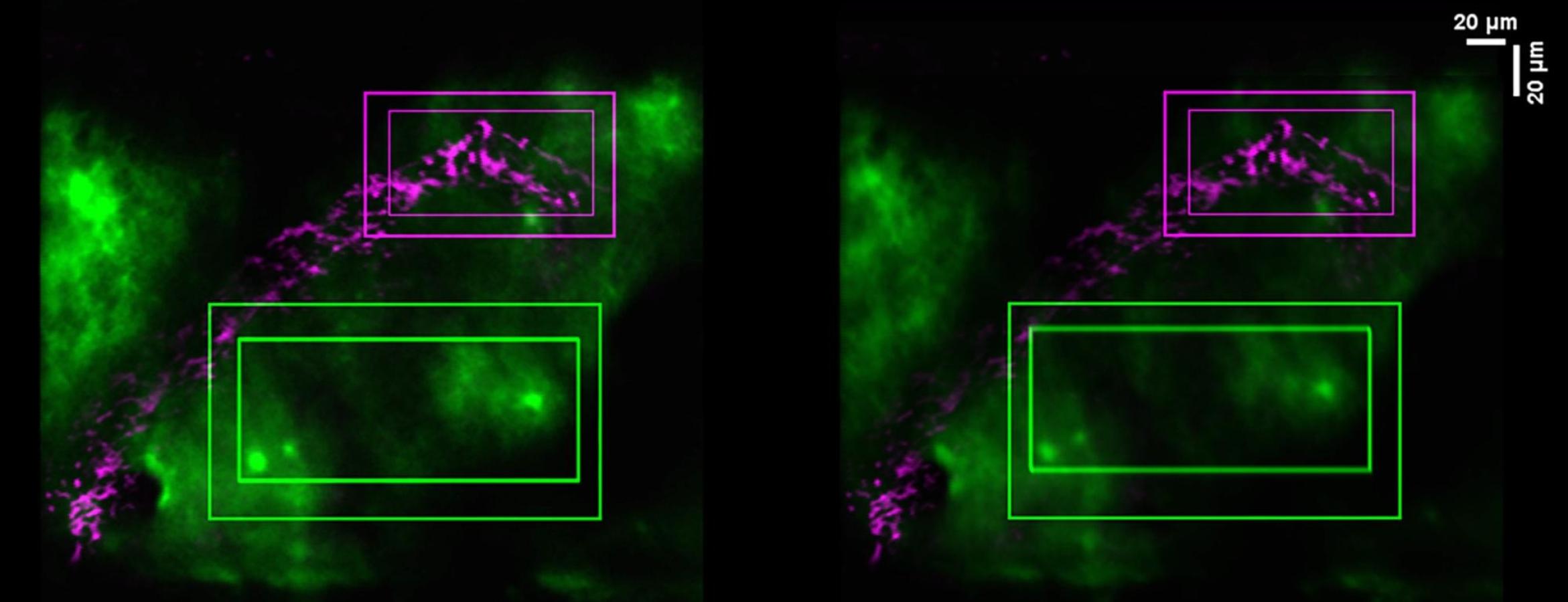 microscopy image of brain tissue, with areas glowing in green and purple