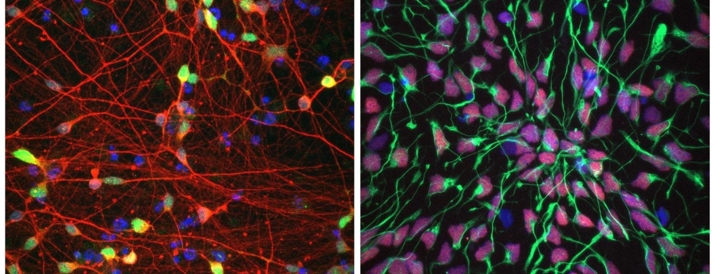 two images of neurons stained with different color dye