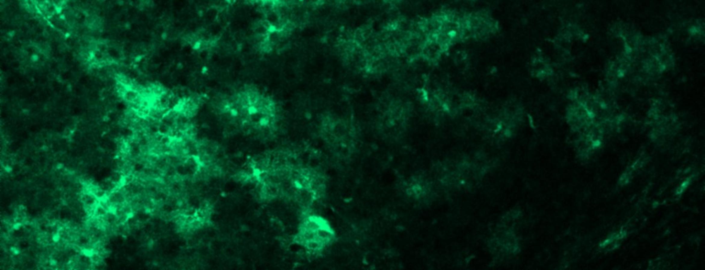 astrocytes in the human brain