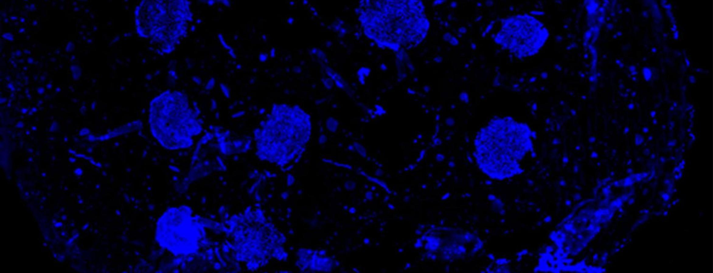 spheroids glowing with fluorescence