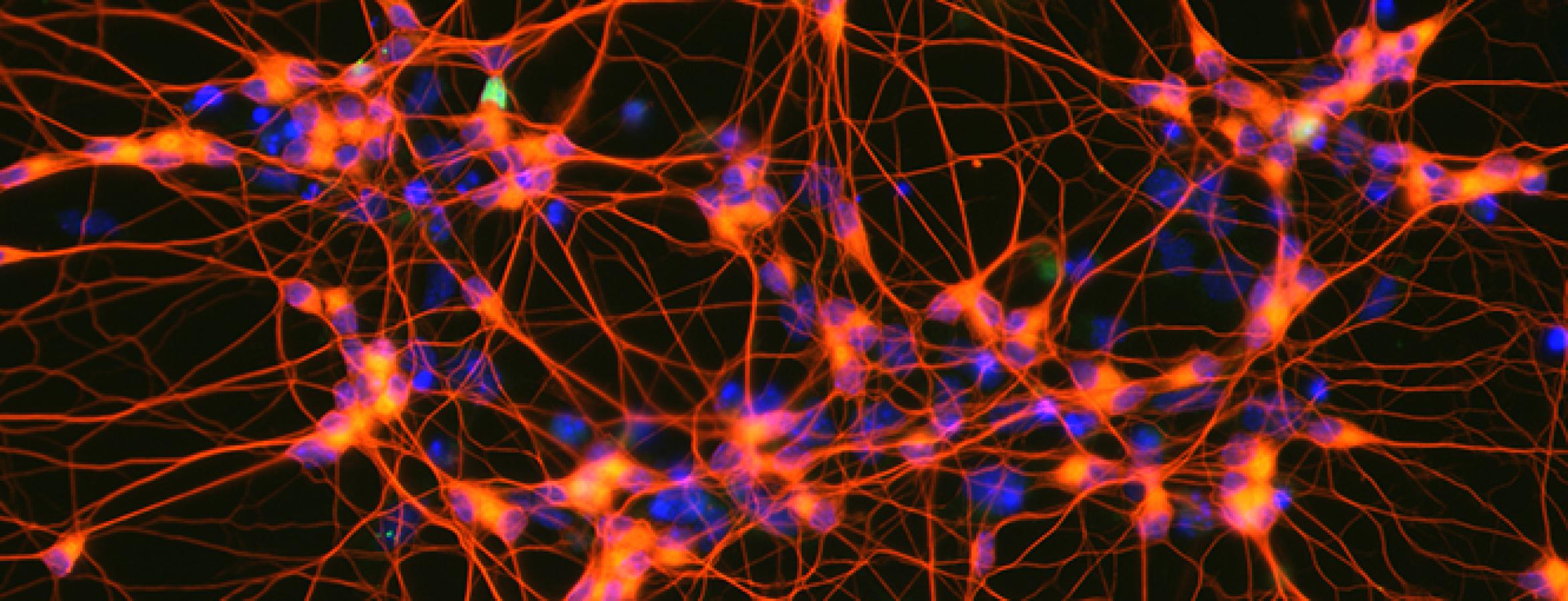 Induced motor neurons created by direct programming from mouse embryonic stem cells. A team of scientists has analyzed the changes that take place in the cells during reprogramming, uncovering a dynamic multi-step process. Credit: Esteban Mazzoni, NYU