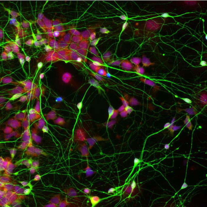 Can Digital Replicas of Patients Help Personalize Alzheimer’s Treatment?